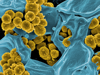Antibiotika-resistente Staphylokokken (gelb) werden von einer weißen Blutzelle bekämpft (blau). Bild: Elektronenmikroskopie (NIAID), digital koloriert (Empa)